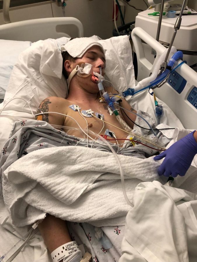 The result of a five-year nicotine addiction that eventually included vaping, 21-year-old Ricky D’ Ambrosio was rushed to the hospital earlier this year after his flu-like symptoms gradually worsened. Physicians determined D’Ambrosio’s vaping caused his then-critical medical condition. 